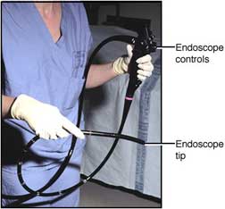 Photo of an endoscope